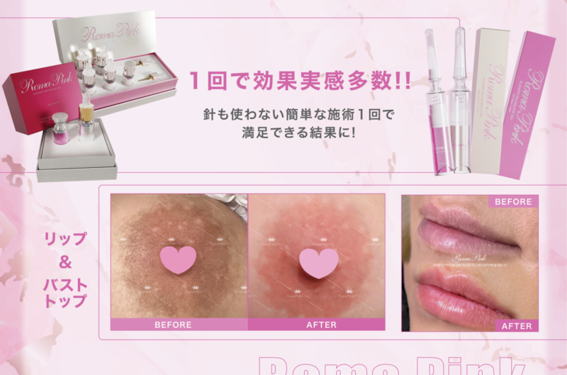 ローマピンクの効果がわからない人まとめ｜よくあるケースと正しい理解」
