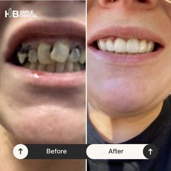 HB SMILE DENTAL - Updated February 2026 - 70 Photos & 43 Reviews