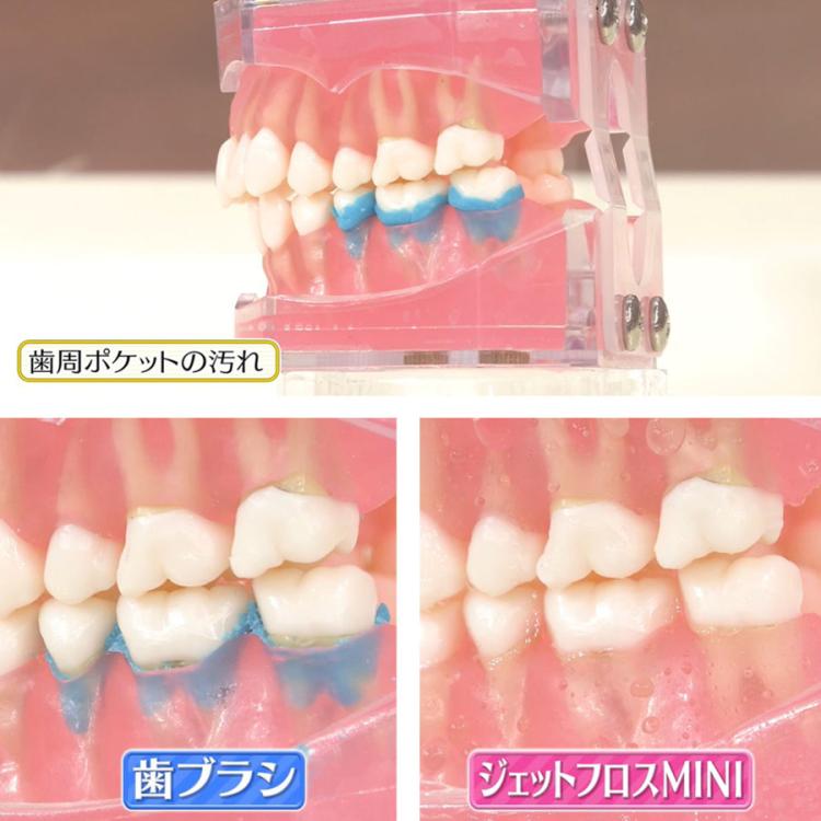 ジェットフロスMINI／舌クリーナーノズル付き／ウォーターフロス／口腔
