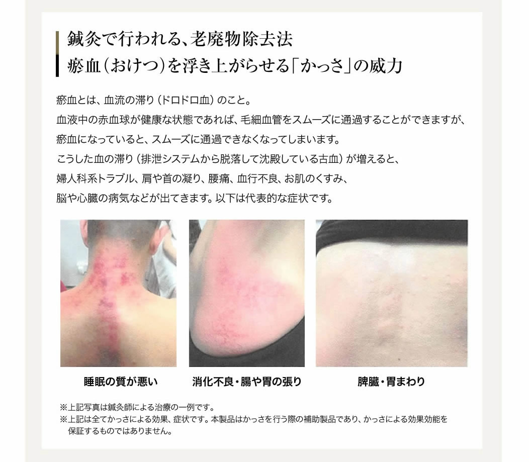 経絡温熱美容器 HEAT PHAGY（ヒートファジー）＜家庭用単体バージョン