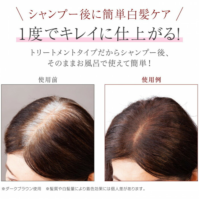 ビューナ 白髪染め ヘアカラートリートメント ダークブラウン 白髪