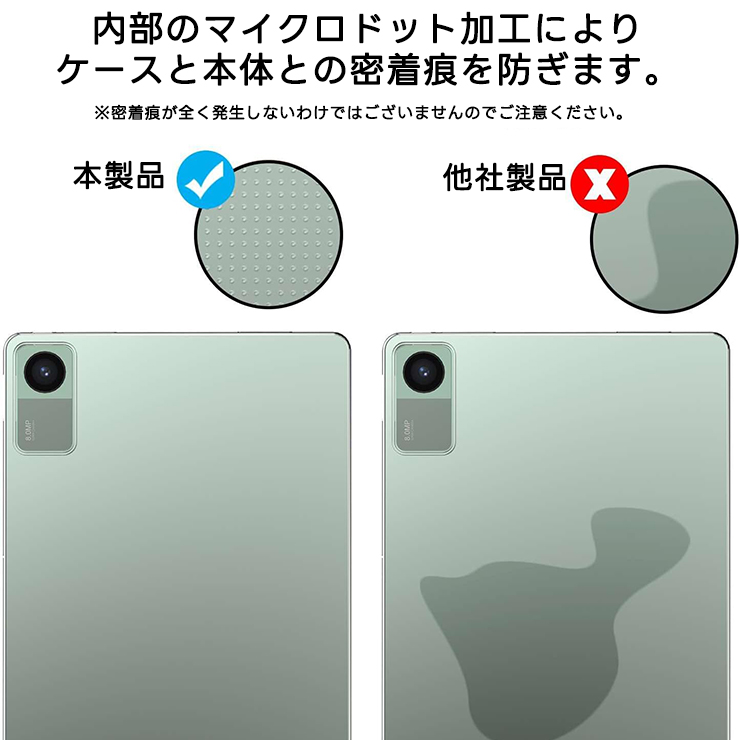 Xiaomi（シャオミ） REDMI Pad 2 ケース Xiaomi Redmi Pad SE 11インチ