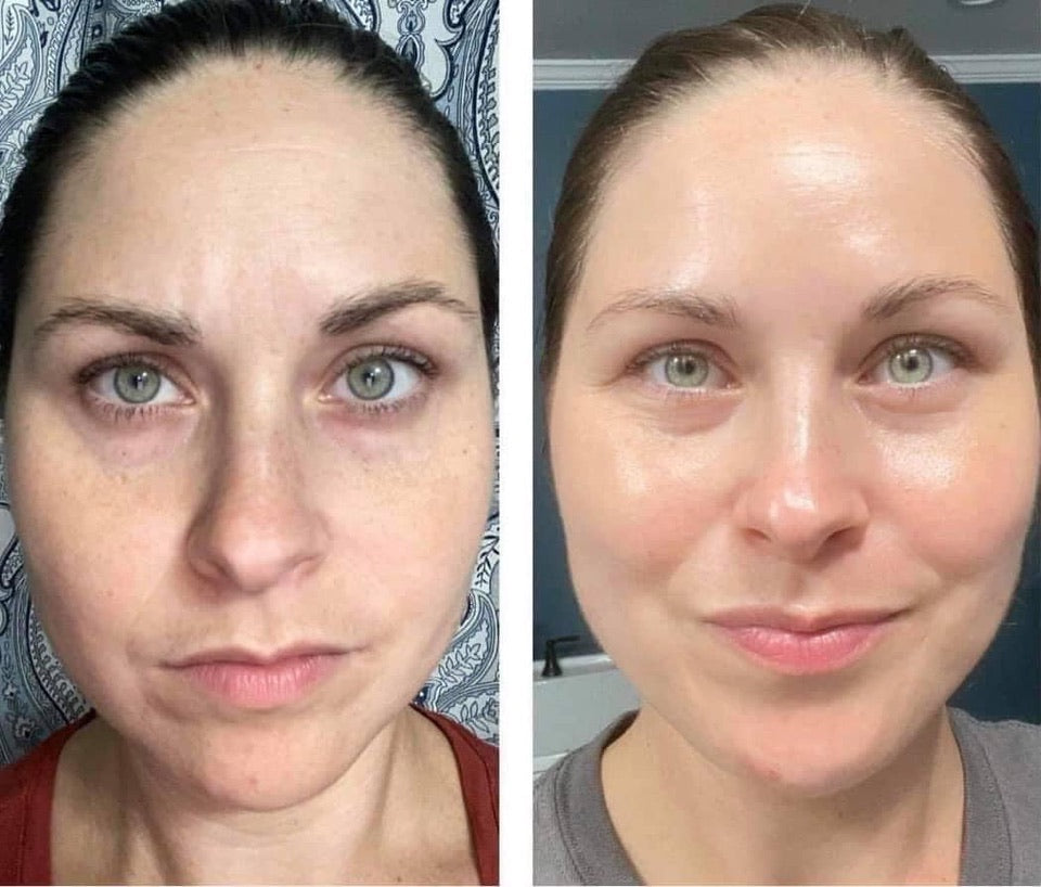 LumiSpa iO Essentials Kit – Social Skin Spa