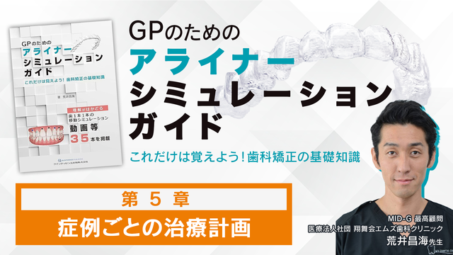 第3章 GPのための最低限の歯科矯正の知識│GPのためのアライナー