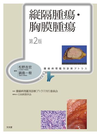 縦隔腫瘍・胸膜腫瘍 | 株式会社文光堂