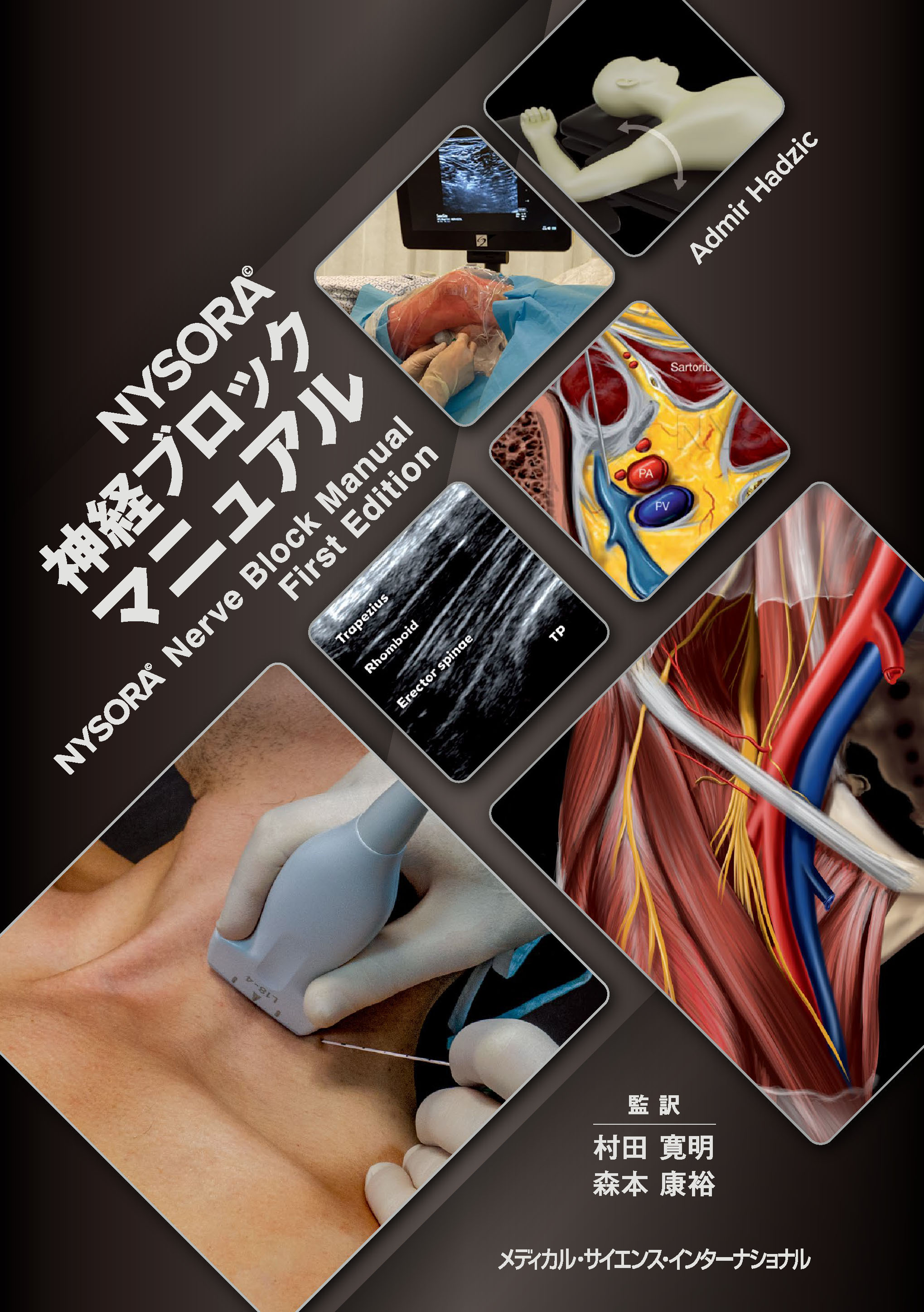 NYSORA神経ブロックマニュアル【電子版】 | 医書.jp