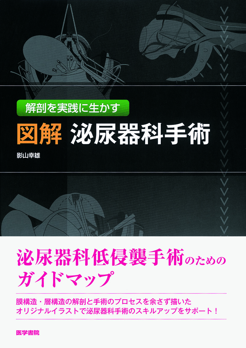 図解 泌尿器科手術【電子版】 | 医書.jp