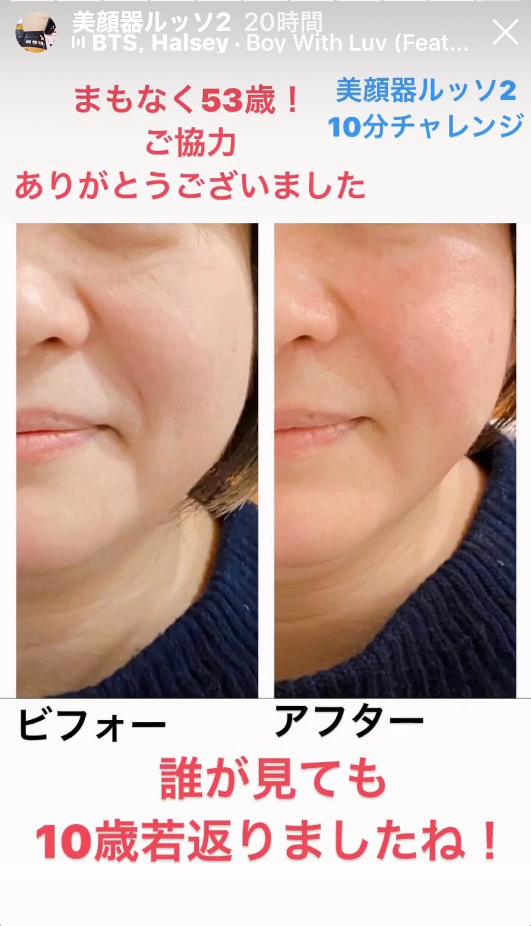 美顔器ルッソ2 ビフォーアフター | 美容室sasukia トータルエステ