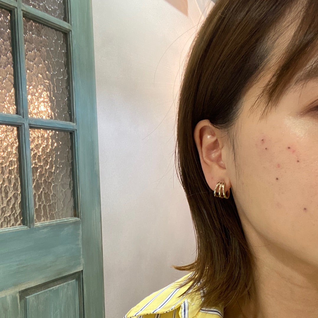 シミ取り》低周波ペンシルしてきました！ | Shiori's「on」style〜干物