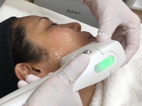 ハイフ治療のとき、お顔にジェルを塗る理由は？ | 青山エルクリニック