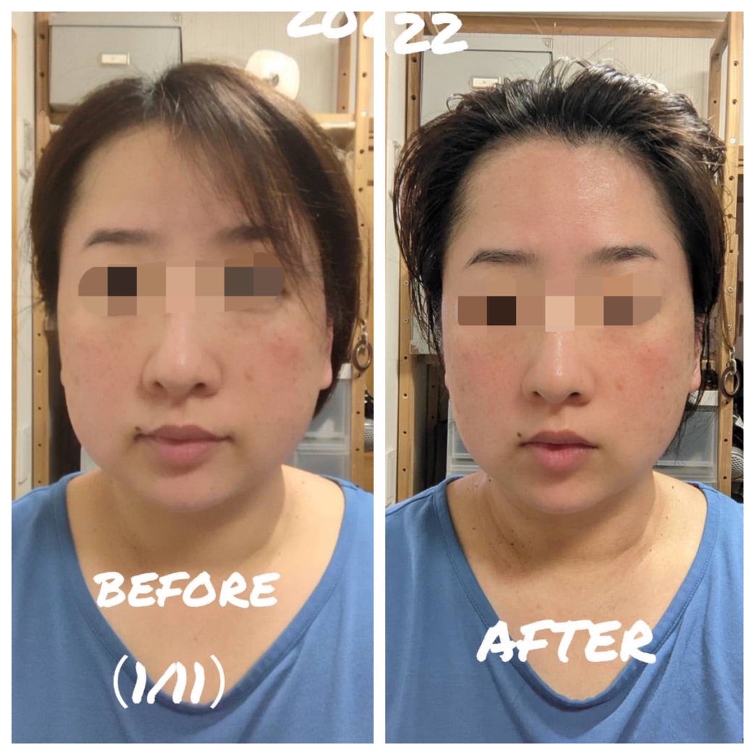 電気バリブラシとデンキバリカッサの違いってなに？ | 脱！老け顔