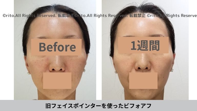 フェイスポインターがリニューアル！ポスポスの違いは？効果は？値段は