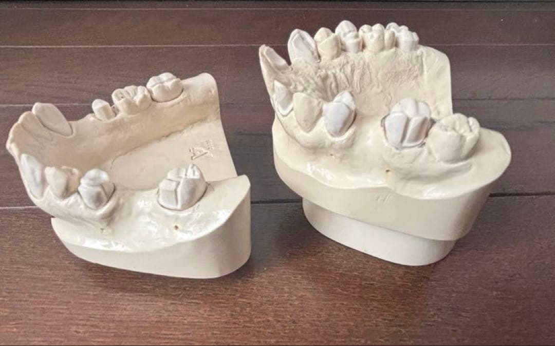 歯科　支台歯形成　練習模型　セット