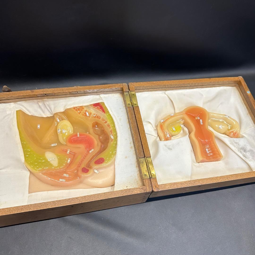 ♡Fc右1008 子宮模型 医療用 断面図 子宮 木製ケース入り 昭和レトロ
