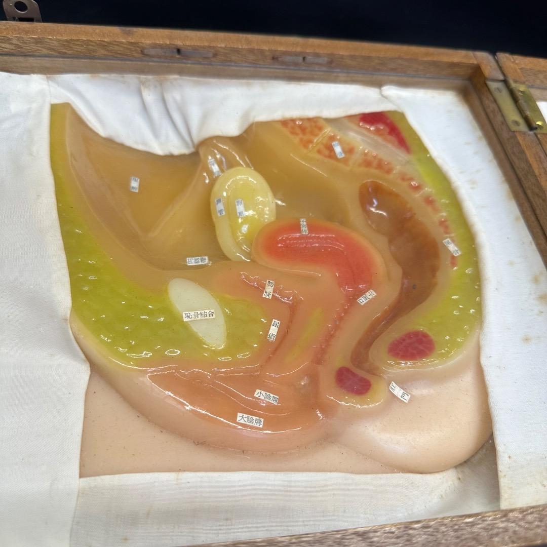 ♡Fc右1008 子宮模型 医療用 断面図 子宮 木製ケース入り 昭和レトロ