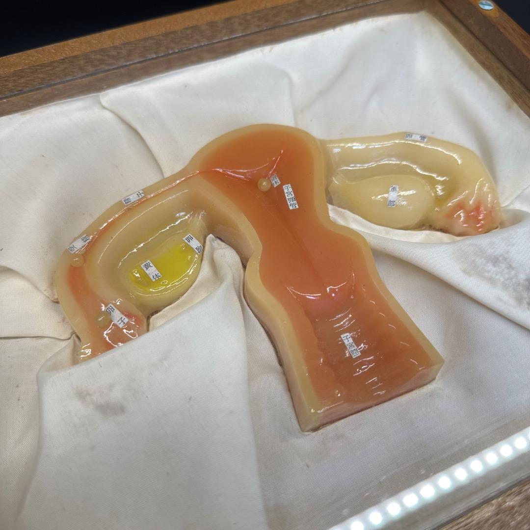 ♡Fc右1008 子宮模型 医療用 断面図 子宮 木製ケース入り 昭和レトロ