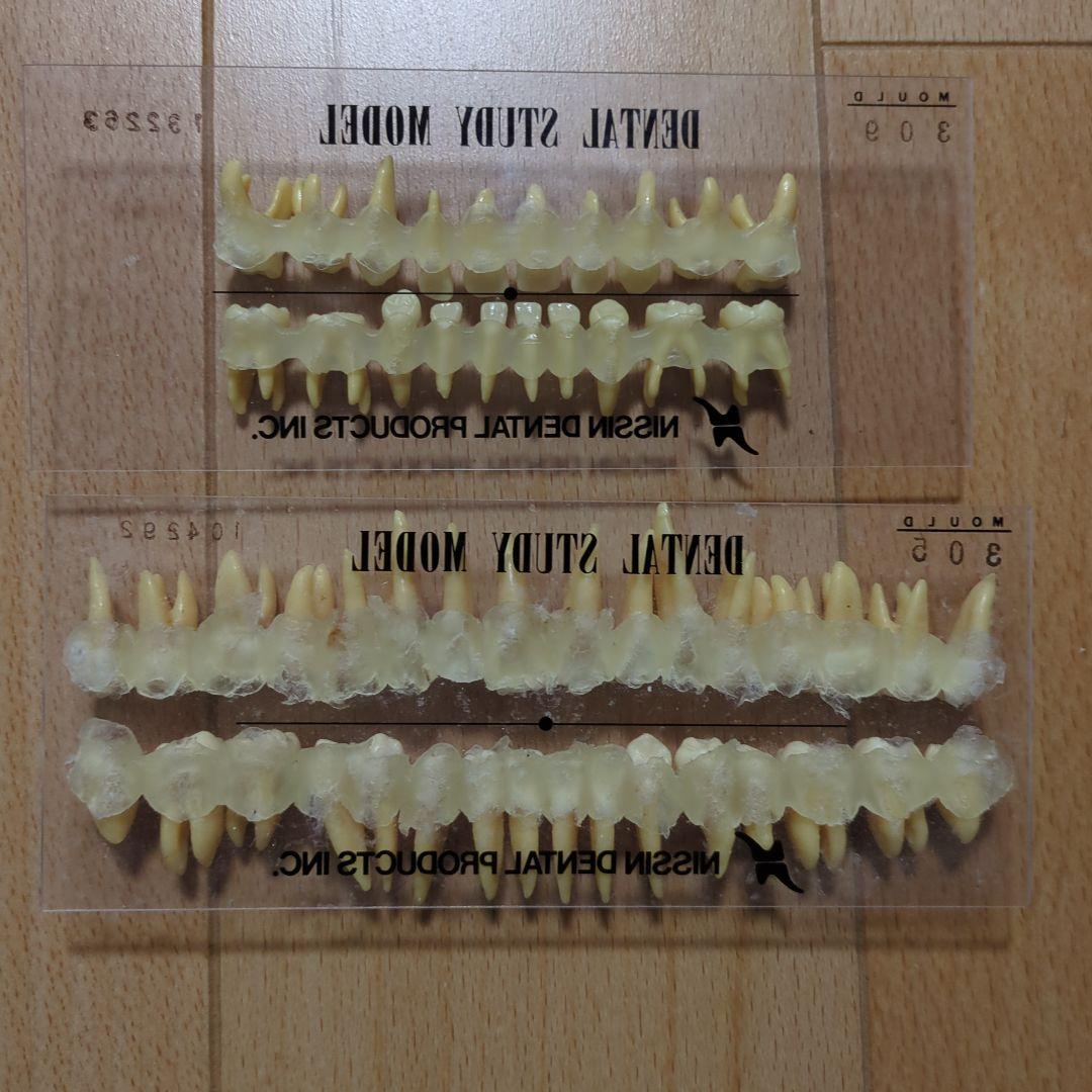 NISSIN 歯科模型 2セットデンタルモデル 乳歯 永久歯 歯牙 - メルカリ