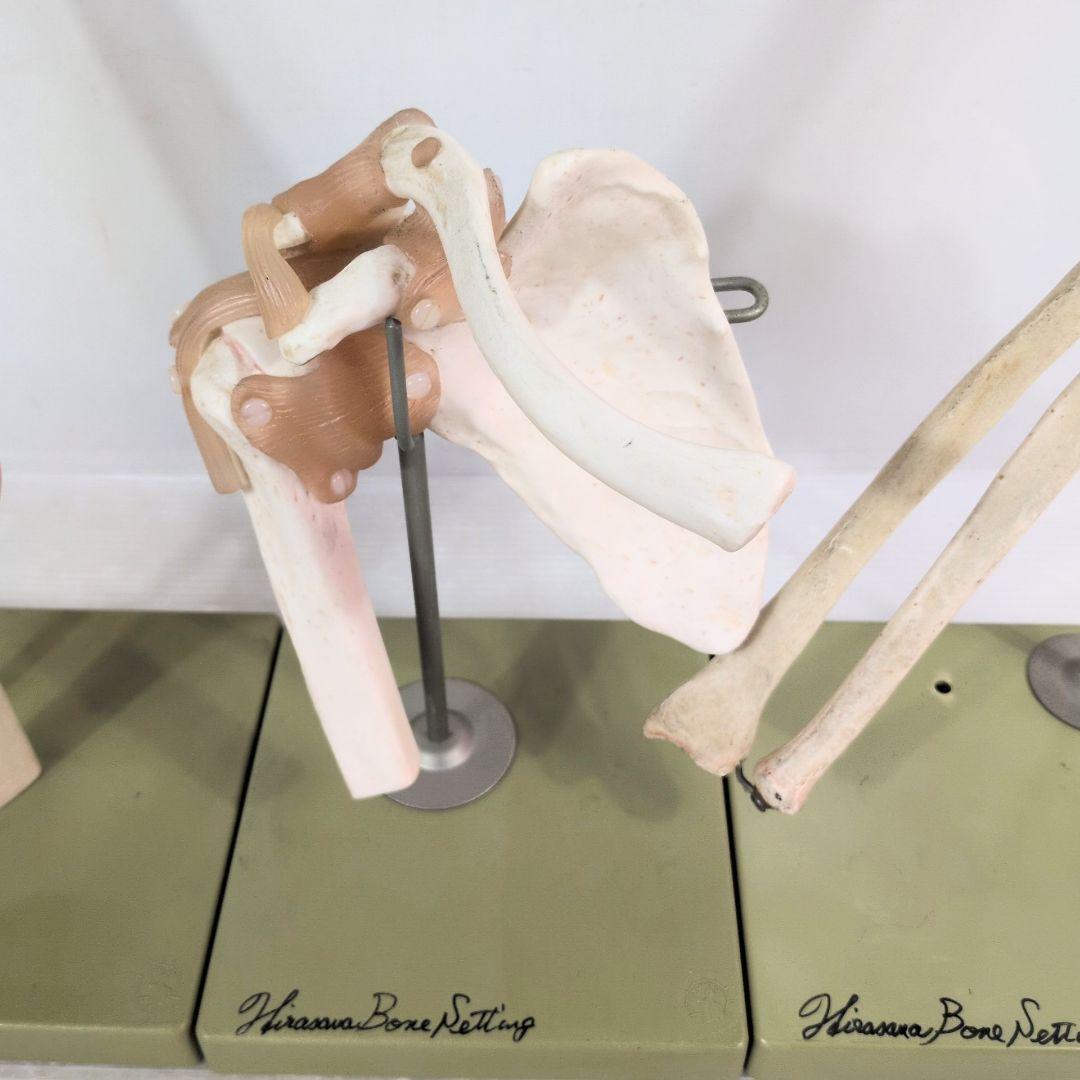 SOMSO 肩関節 膝関節 肘関節 椎間板 模型 ソムソ ドイツ製 人体模型