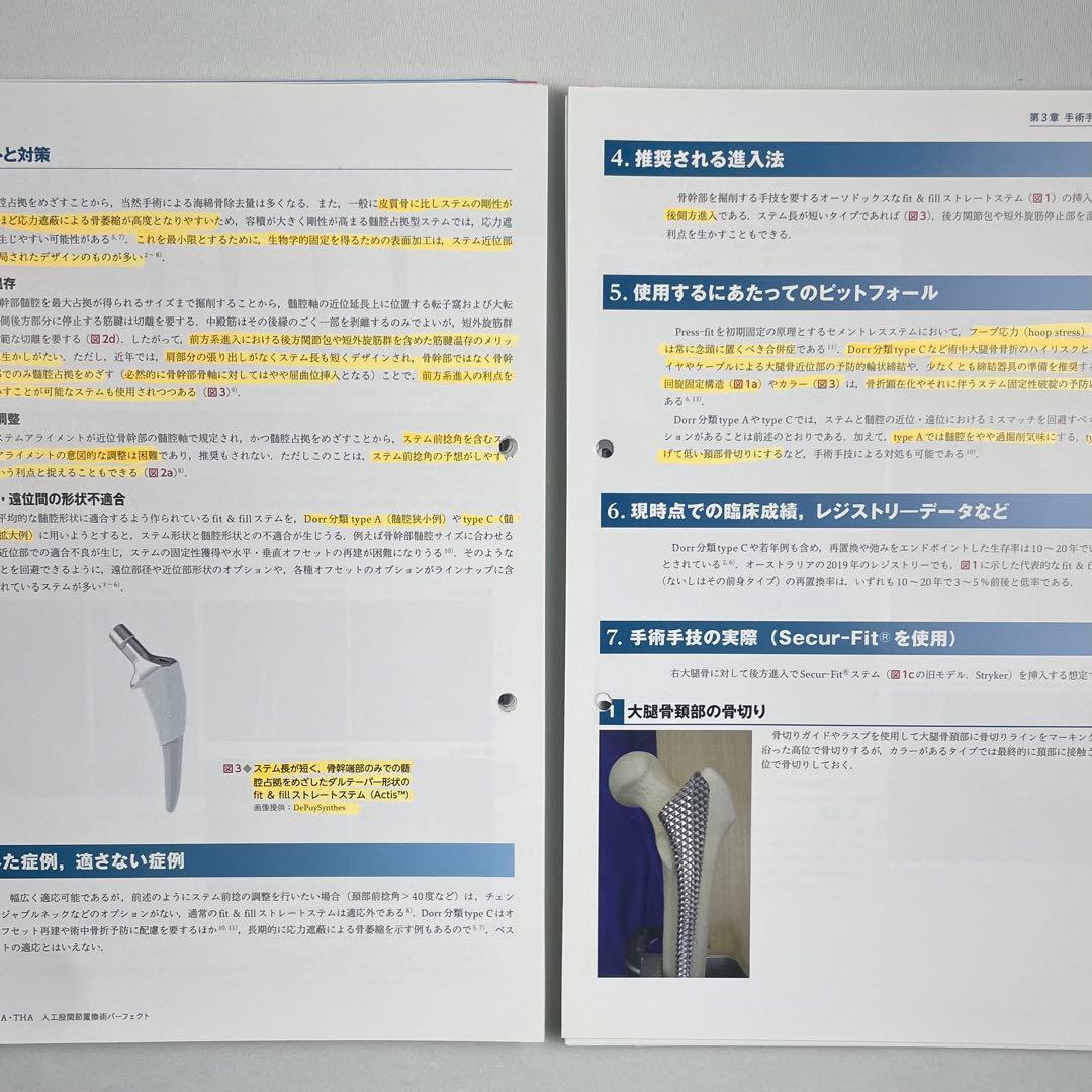裁断済】BHA・THA 人工股関節置換術パーフェクト - メルカリ