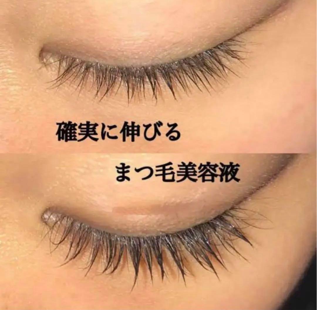 EMAKED（エマーキット） まつ毛美容液✖︎5本セット - メルカリ