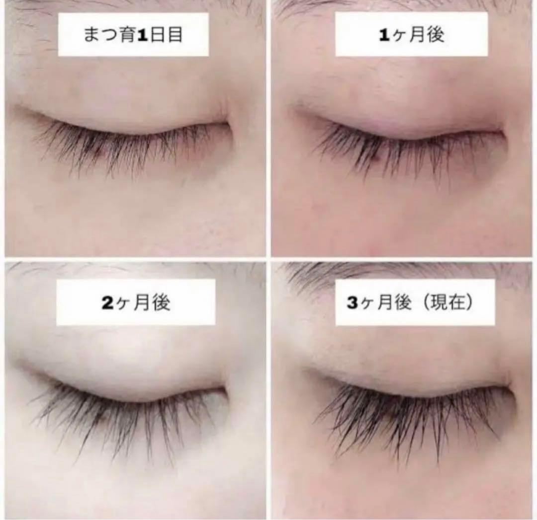 EMAKED（エマーキット） まつ毛美容液✖︎5本セット - メルカリ